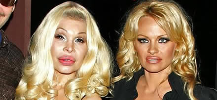 Chirurgia delle celebrit: Pamela Anderson e Amanda Lepore