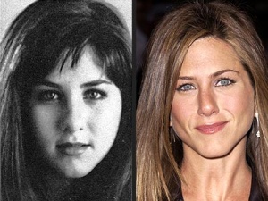 Chirurgia delle celebrità: Jennifer Aniston