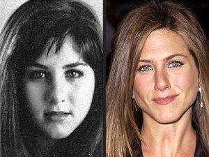 Chirurgia delle celebrit: Jennifer Aniston