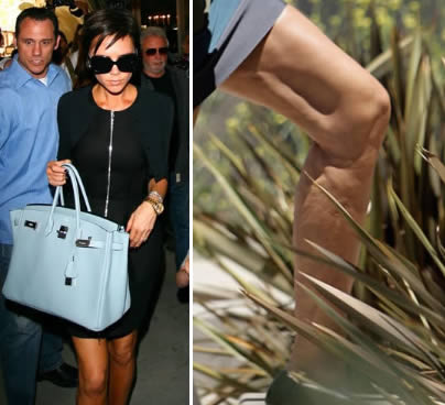 Celebrit cellulite: Victoria Beckham e la cellulitee