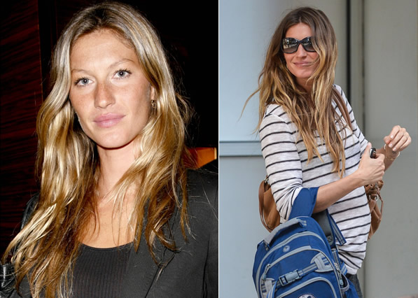 Gisele Bündchen: Chirurgia estetica da star