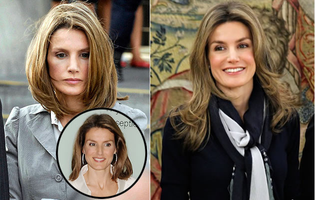 Chirurgia celebrità: La Regina Letizia e la Chirurgia
